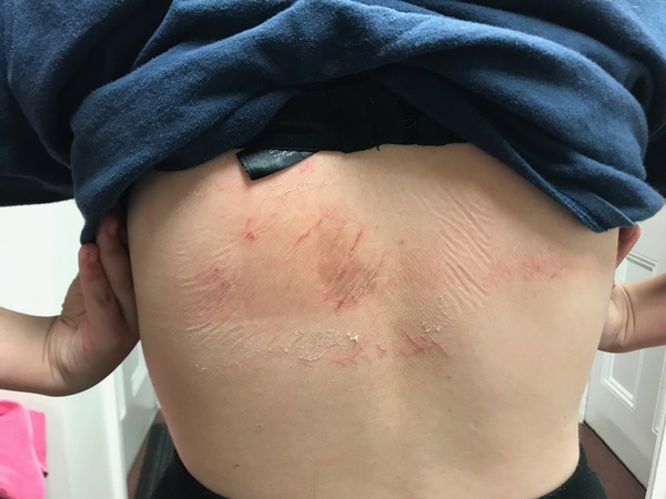 What on Earth has happened to DD back?