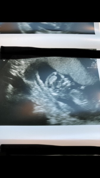 12 + 5 scan. Any guesses?