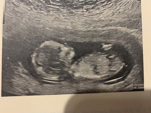 Do you want me to guess the sex? 12 week scans.