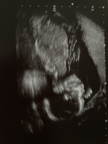 Any guesses on sex?