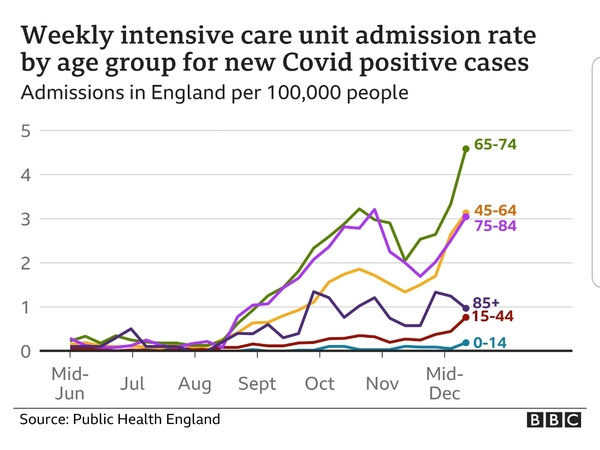 Has the age of patients in ICU changed?