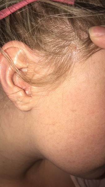 Anyone know what this could be on my scalp?