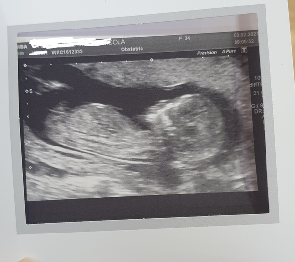 Do you want me to guess the sex? 12 week scans.