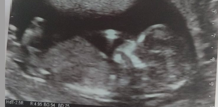 Boy or Girl guesses?