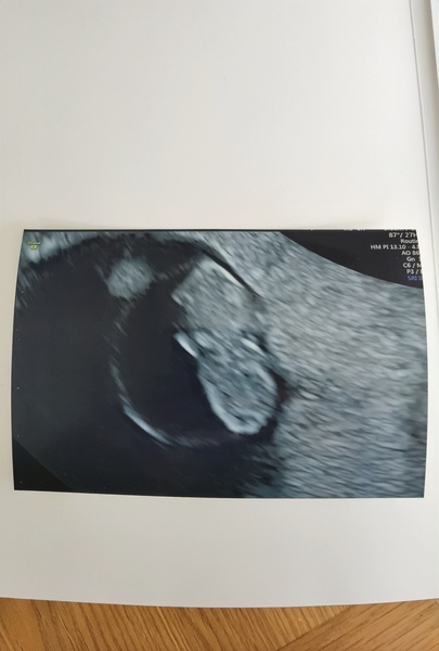 September 2021 thread 2🥳