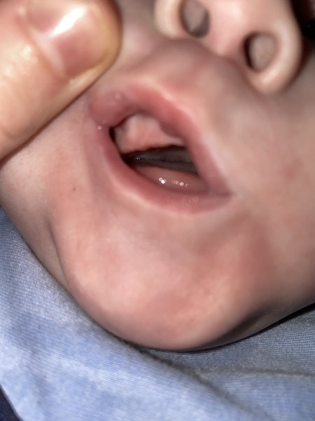 Help is this teething?