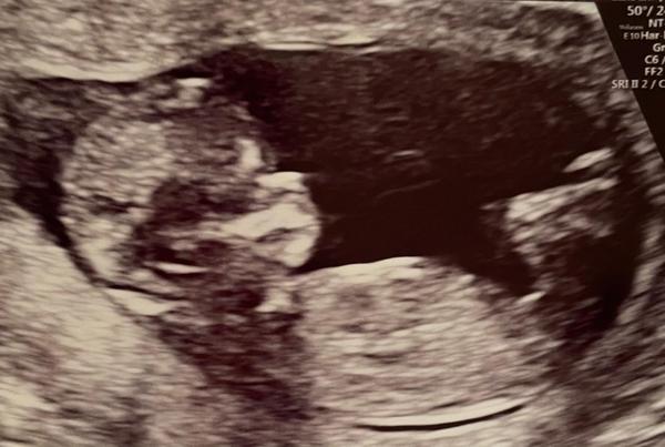 Any gender guesses?