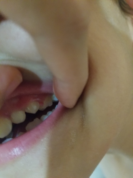 any dentists/dental nurses about?