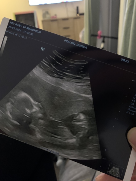 August 2021 - Heading into the second trimester