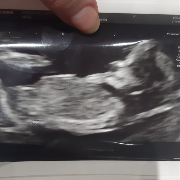 August 2021 - Scans and booking in!