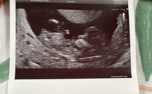 Do you want me to guess the sex? 12 week scans.