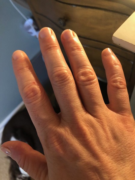 Please help me stop nail biting!