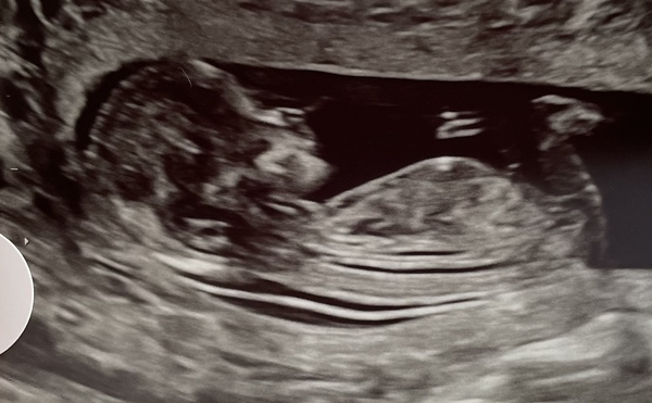 Do you want me to guess the sex? 12 week scans.