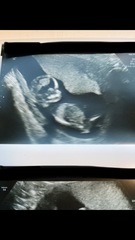 Do you want me to guess the sex? 12 week scans.