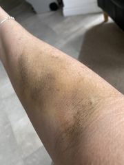 Any phlebotomists help please.