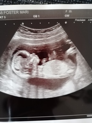 Do you want me to guess the sex? 12 week scans.