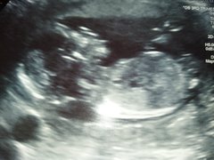 Do you want me to guess the sex? 12 week scans.