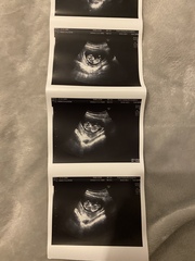 Gender predictions ??