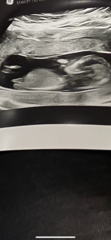 Do you want me to guess the sex? 12 week scans.