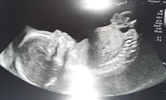 Gender guess?