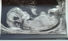 Nub theory