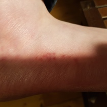 What's this on my foot?