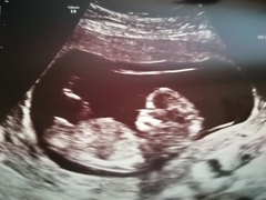 Do you want me to guess the sex? 12 week scans.