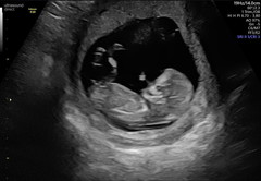 Do you want me to guess the sex? 12 week scans.