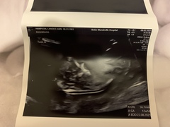 August 2021 - Scans and booking in!