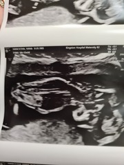 Do you want me to guess the sex? 12 week scans.
