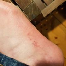 What's this on my foot?