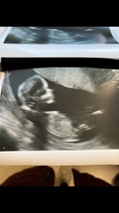 Do you want me to guess the sex? 12 week scans.