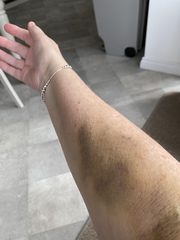 Any phlebotomists help please.