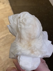 Pink tinge discharge