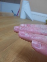 Any dermatologists about?