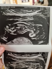 Do you want me to guess the sex? 12 week scans.