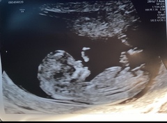 Do you want me to guess the sex? 12 week scans.