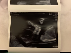 August 2021 - Scans and booking in!