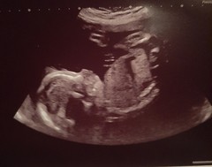Do you want me to guess the sex? 12 week scans.