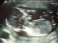 Do you want me to guess the sex? 12 week scans.