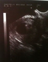 CD1 (again!) - No more relaxed approach..