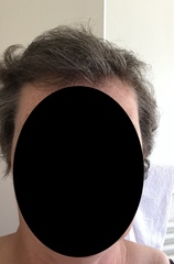 Should I shave all my hair off?