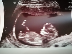 Do you want me to guess the sex? 12 week scans.