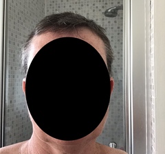 Should I shave all my hair off?