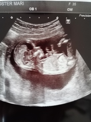 Do you want me to guess the sex? 12 week scans.