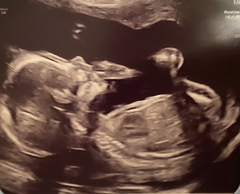 20 week scan profile, has sonographer revealed gender?