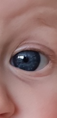 Baby eyelid