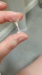 Cervix mucus 9dpo sensitive