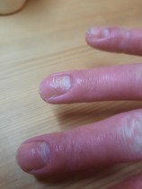 Any dermatologists about?
