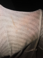 Spotting or dried discharge? TMI
